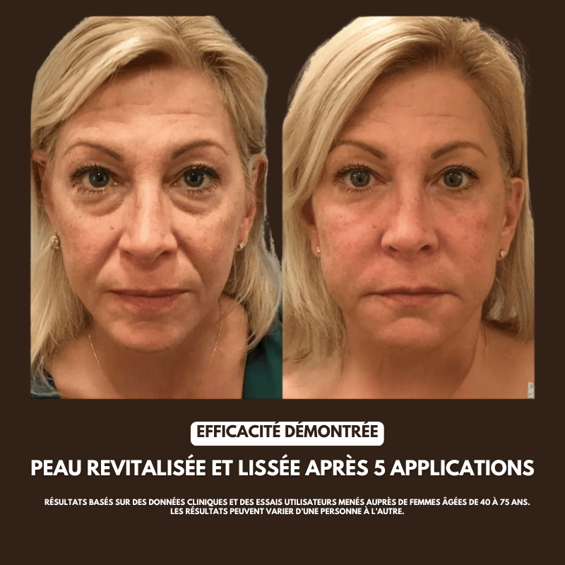 Brosse Drainage Lymphatique