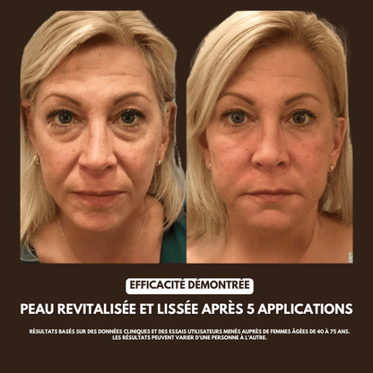 Brosse Drainage Lymphatique