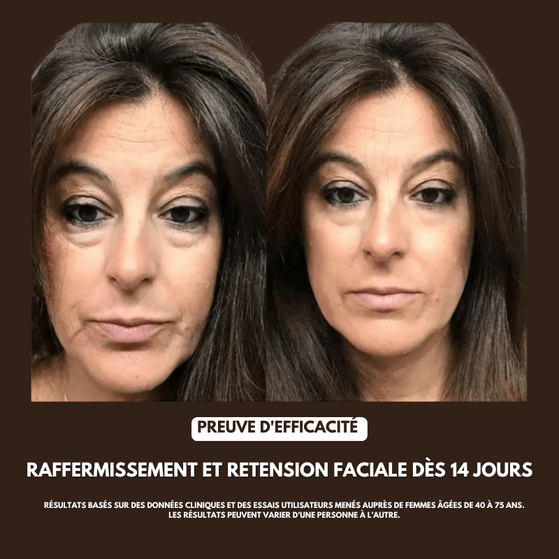 Brosse Drainage Lymphatique